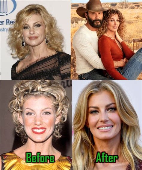 has faith hill had plastic surgery|Are Faith Hills plastic surgery rumours。